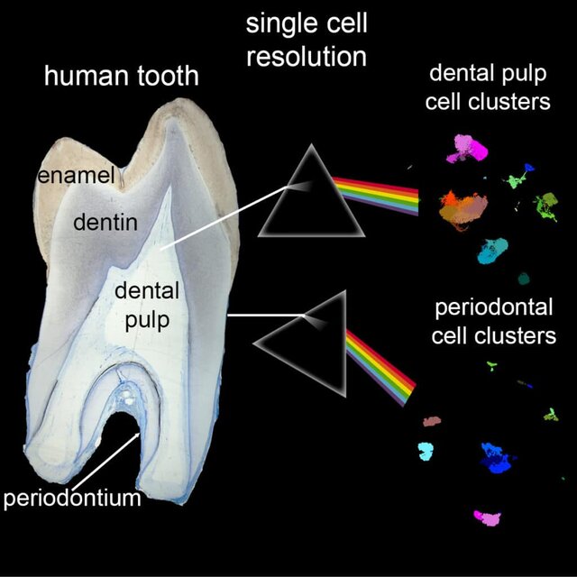 اولین اطلس کامل سلولی دندان‌های انسان ایجاد شد