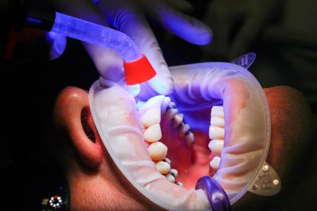 بیماری‌های شایع دندان و راه‌های مقابله با آن
