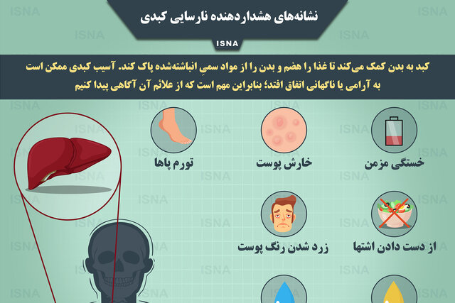 اینفوگرافیک / نشانه‌های هشداردهنده نارسایی کبدی