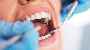 با بیمه دندانپزشکی، هزینه گزاف دندان پزشکی را در 1400 به صفر برسانید