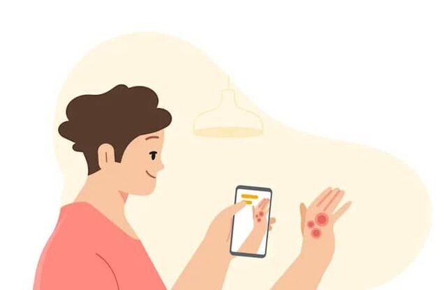 شناسایی بیماری‌های شایع پوست و تشخیص "سل" توسط هوش مصنوعی جدید گوگل