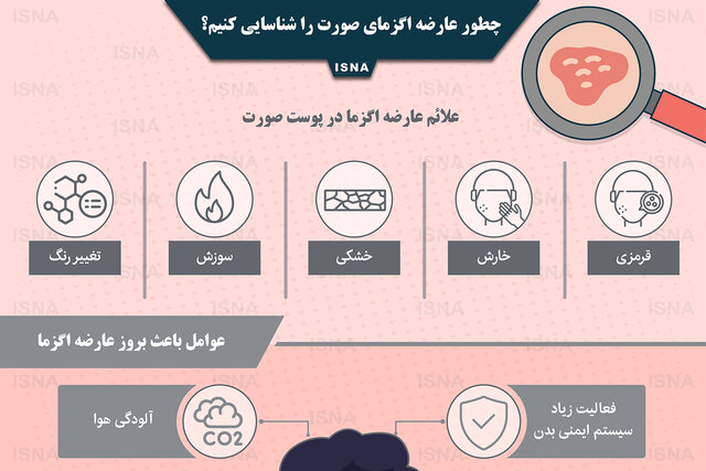 اینفوگرافیک / چطور عارضه اگزمای صورت را شناسایی کنیم؟