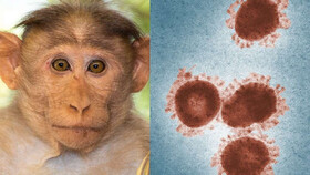 بیماری آبله میمونی چیست؟+ علایم، عوارض و واکسن ویروس آبله میمون ۱۴۰۰