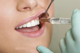 آیا جرم‌گیری برای دندان مضر است؟