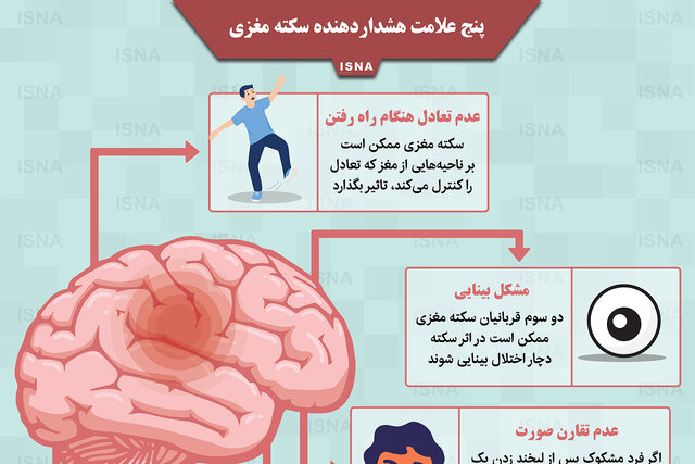 اینفوگرافیک / پنج علامت هشداردهنده سکته مغزی