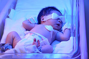 درمان غیرعلمی زردی نوزاد عوارض دائمی به دنبال دارد