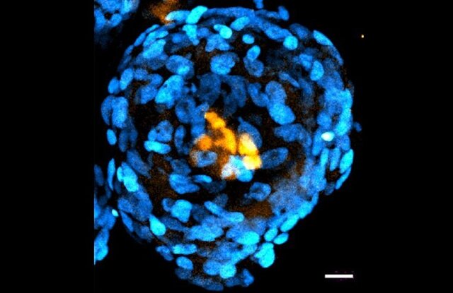 ایجاد ساختاری مشابه جنین انسان از سلول‌های بنیادی
