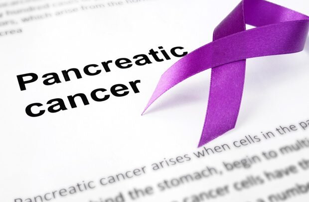 شناسایی علائم جدید مرتبط با سرطان لوزالمعده