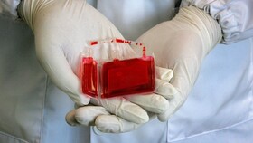 کاربردهای "خون بند ناف" در درمان بیماری های مهم