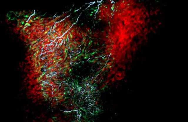 کشف یک سلول جدید در قلب کشف یک سلول جدید در قلب