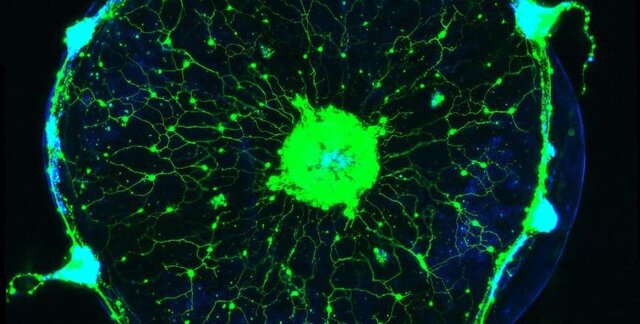 خواندن ذهن یک عروس دریایی توسط محققان "کلتک"