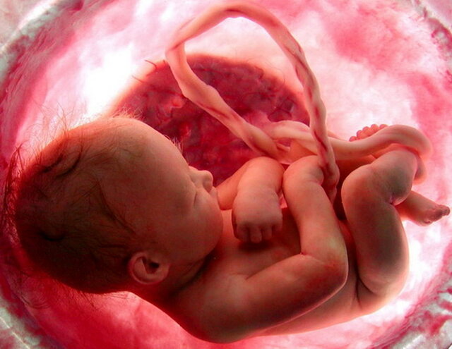 ذخیرهسازی سلولهای بنیادی خون بندناف، پشتوانه سلامت خانواده ذخیرهسازی سلولهای بنیادی خون بندناف، پشتوانه سلامت خانواده