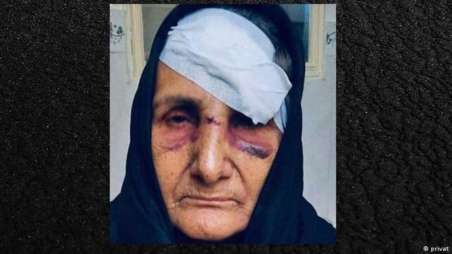 اولین واکنش رسمی به ضرب و شتم گوهر عشقی اولین واکنش رسمی به ضرب و شتم گوهر عشقی