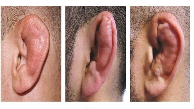 گوششکنی در ۱۰ دقیقه!