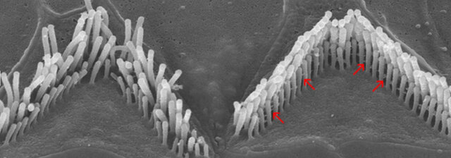 بازگشت شنوایی از دست رفته با کمک یک روش جدید ژندرمانی