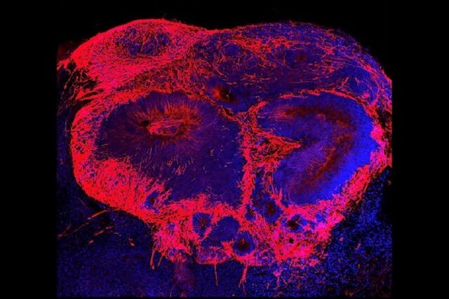 مغزهای کوچک آزمایشگاهی، سرنخهایی را در مورد آغاز اسکیزوفرنی آشکار میکنند مغزهای کوچک آزمایشگاهی، سرنخهایی را در مورد آغاز اسکیزوفرنی آشکار میکنند