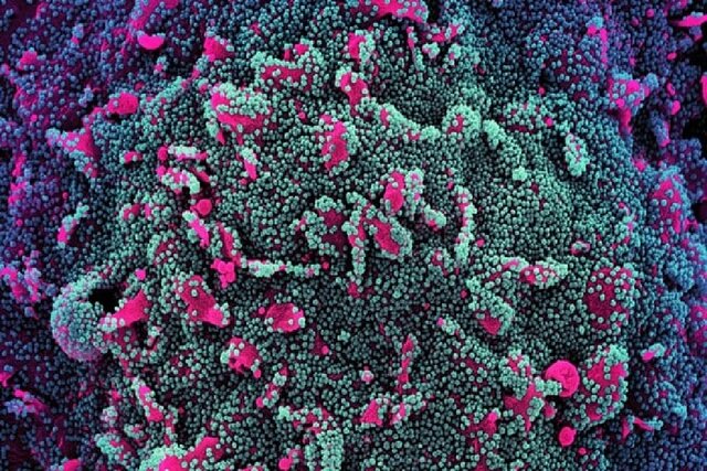 تفاوت واکنش ایمنی در بیماران مبتلا به نوع خفیف و شدید کووید-۱۹