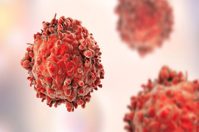 شناسایی راهی موثر برای درمان سرطان پوست شناسایی راهی موثر برای درمان سرطان پوست