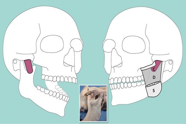 کشف لایه عضلانی جدیدی در فک انسان! کشف لایه عضلانی جدیدی در فک انسان!