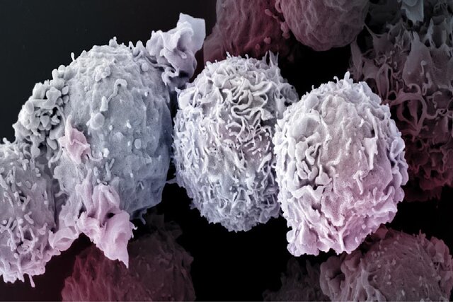 دلایل ادامه نیافتن مطالعات بر روی درمان سرطان با نانوذرات فلزی