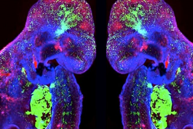 پرورش اندامهای انسان در آزمایشگاه با یک پیشرفت جدید پرورش اندامهای انسان در آزمایشگاه با یک پیشرفت جدید