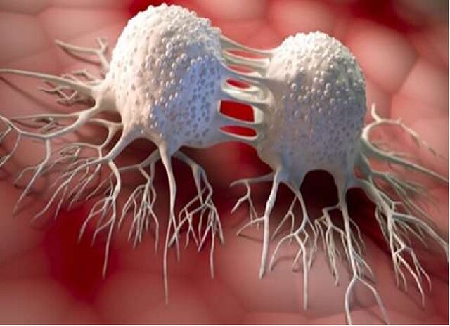 امکان تشخیص دقیق تودههای سرطانی با ابزار ایرانساخت امکان تشخیص دقیق تودههای سرطانی با ابزار ایرانساخت