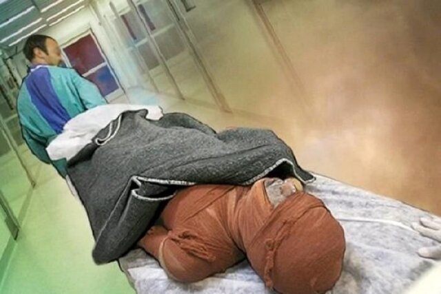 عکس آرشیوی است. با رعایت چند نکته ساده از سوختگی پیشگیری کنید