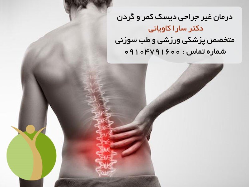 درمان غیرجراحی دیسک کمر و گردن