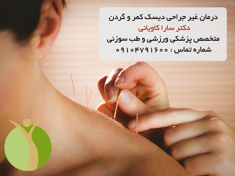 درمان غیرجراحی دیسک کمر و گردن