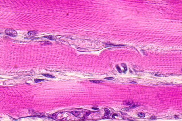 ورزش کردن میتواند عضلات را تا ۱۰ درصد جوانتر کند