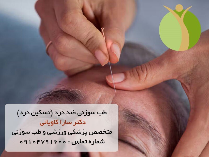 طب سوزنی ضد درد (تسکین درد)