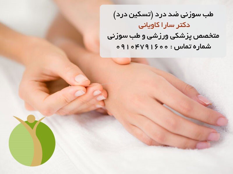 طب سوزنی ضد درد (تسکین درد)