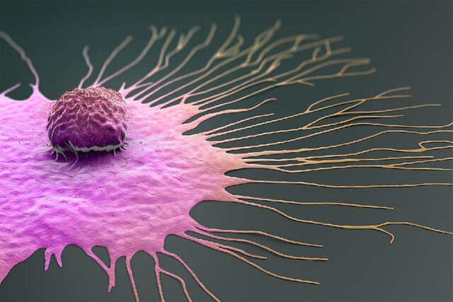 سرطان پستان چگونه در بدن پیشروی می‌کند؟