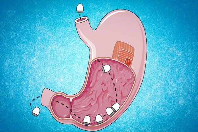 کپسولی که میتواند جایگزین واکسن شود!