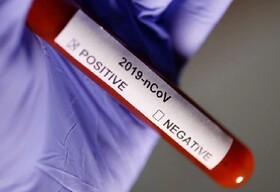 روند تزریق دوز سوم واکسن کرونا در الیگودرز کند است