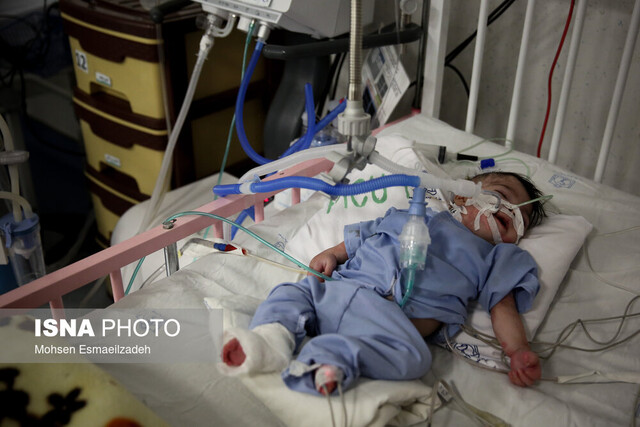 بستری ۳ کودک مبتلا به کرونا در بیمارستان‌های زنجان