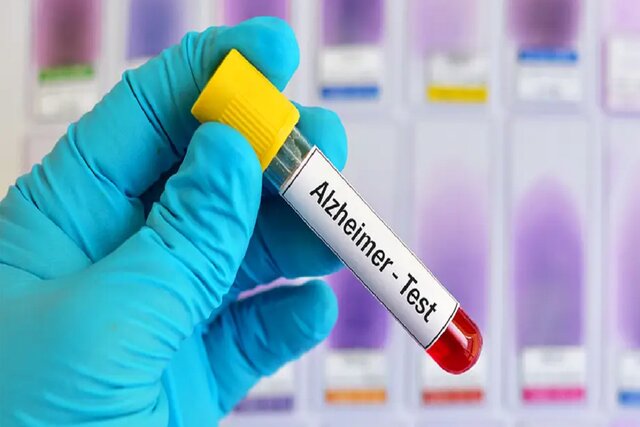 نتایج امیدبخش نوعی آزمایش خون در تشخیص آلزایمر نتایج امیدبخش نوعی آزمایش خون در تشخیص آلزایمر
