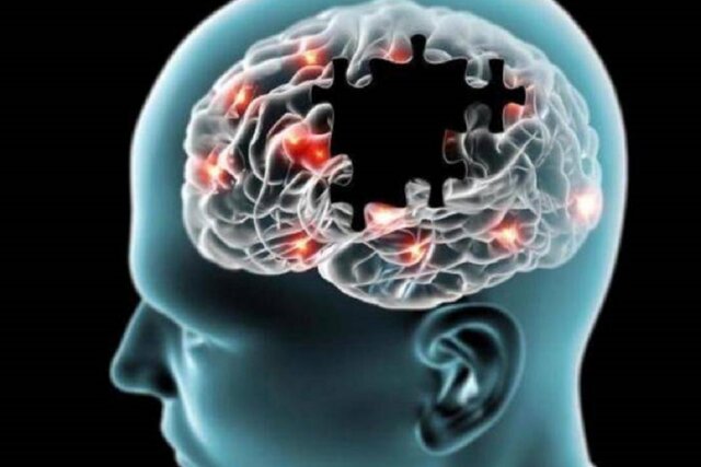 نقش مهم لیپیدها در بروز آلزایمر نقش مهم لیپیدها در بروز آلزایمر