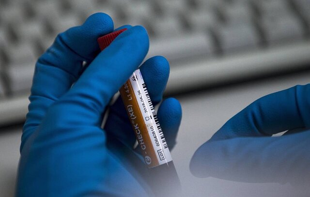 محرومیت ۱۳ ماهه دوپینگ برای ملیپوش اسکیت زنان ایران!