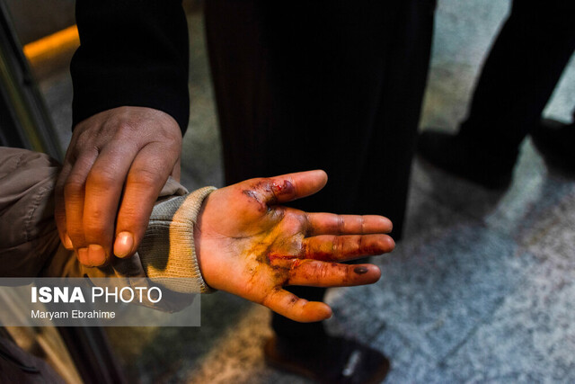 شمار مصدومان حوادث چهارشنبه آخر سال در کردستان به 85 نفر رسید شمار مصدومان حوادث چهارشنبه آخر سال در کردستان به 85 نفر رسید