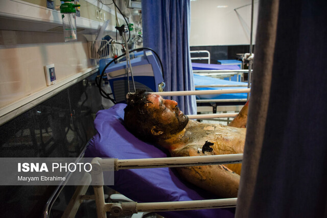 قطع عضو عیدی حوادث چهارشنبهسوری/ حسرت ابدی برای شادی آنی