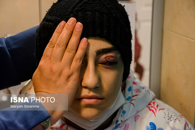 قطع عضو عیدی حوادث چهارشنبهسوری/ حسرت ابدی برای شادی آنی