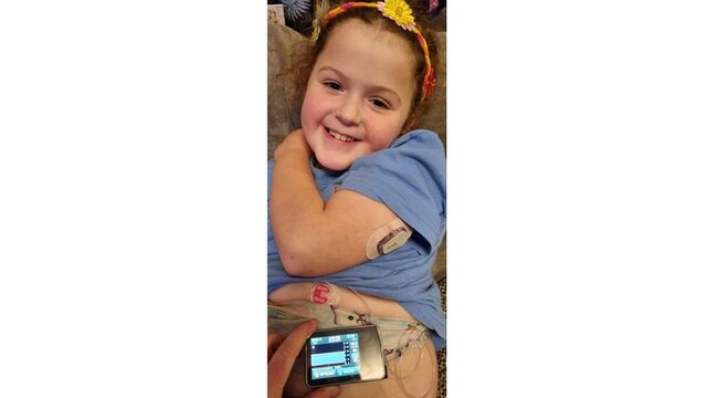 لوزالمعده مصنوعی، روزنه امید مبتلایان به دیابت