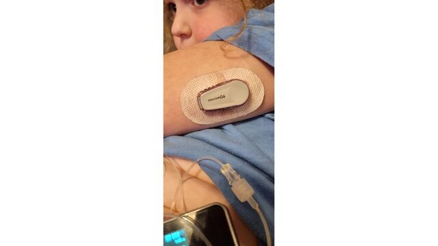 لوزالمعده مصنوعی، روزنه امید مبتلایان به دیابت