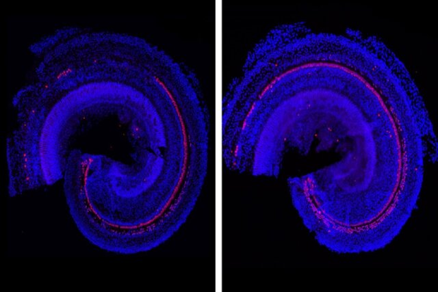 داروی جدید دانشمندان MIT برای کم‌شنوایی