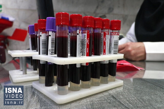 از آبله میمون نترسید