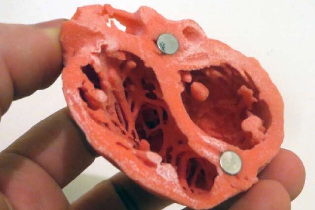 یافتههای جدیدی در مورد ارتباط افسردگی با بیماری قلبی-عروقی یافتههای جدیدی در مورد ارتباط افسردگی با بیماری قلبی-عروقی