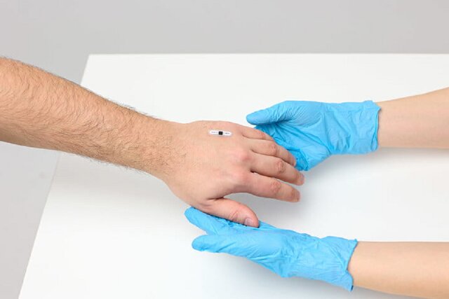 استفاده از ایمپلنت قابل کاشت در بدن به جای کارت بانکی!