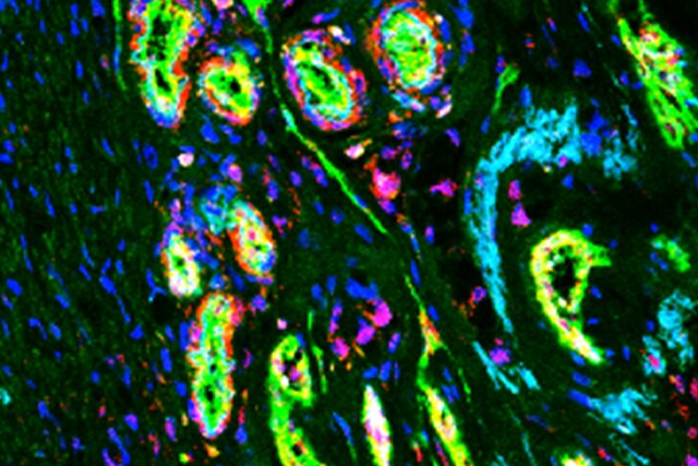 شناسایی یک هدف مولکولی جدید برای درمان سرطان شناسایی یک هدف مولکولی جدید برای درمان سرطان