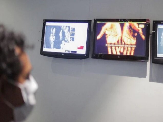 عکس خبر تزیینی است. انجام ۲۹۱ تست آبله میمونی در کشور؛ تاکنون/نیازی به واکسیناسیون عمومی علیه آبله نیست